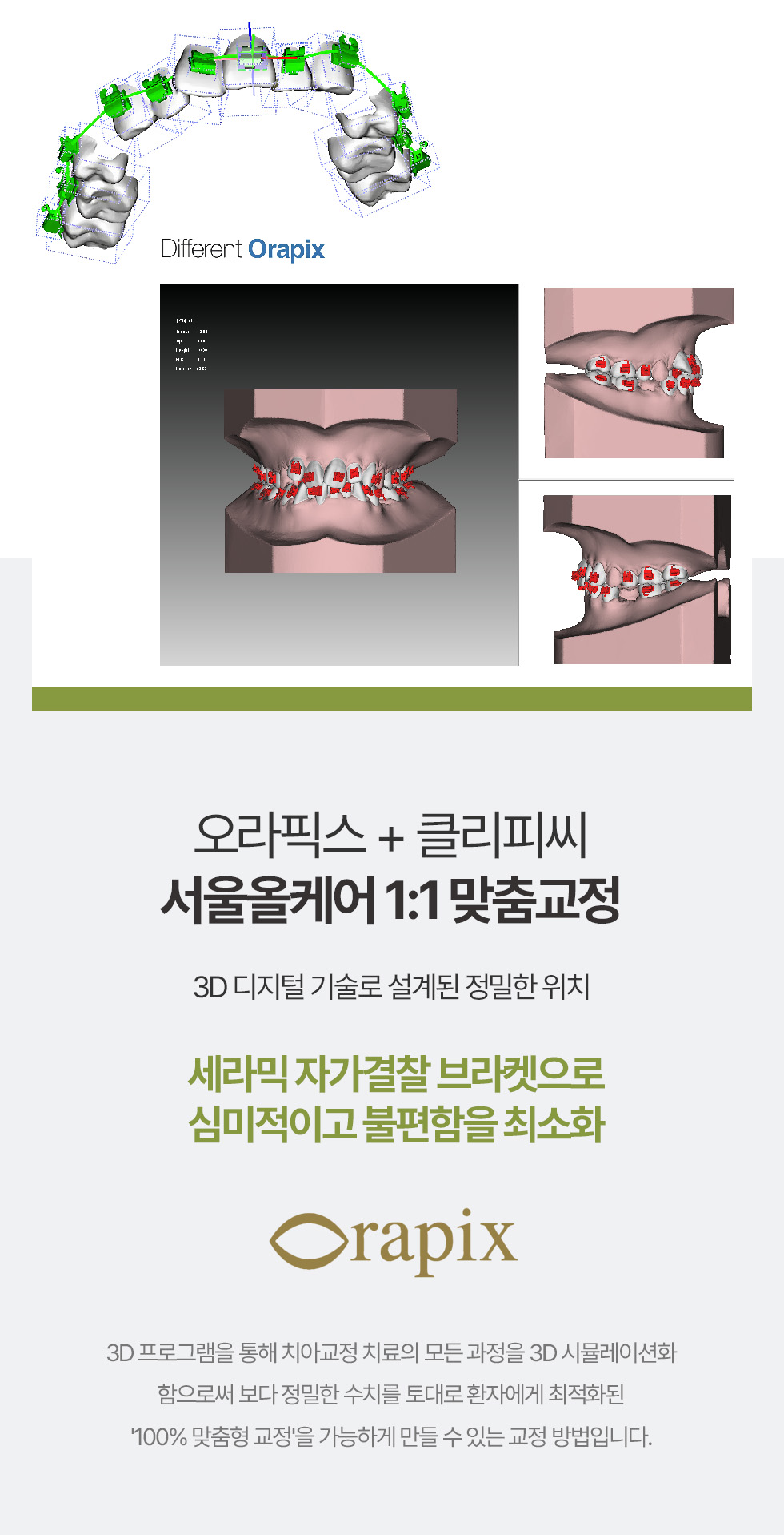 오라픽스 + 클리피씨 서울올케어 1:1 맞춤교정